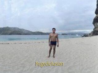 Hugedickasian