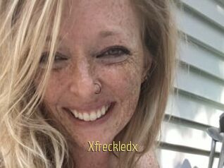Xfreckledx